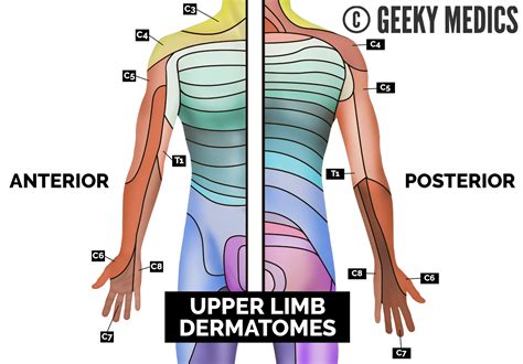 Dermatome Of Upper Limb Ppt Dermatomes Chart And Map | sexiezpix Web Porn