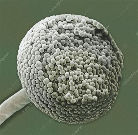 Spores on the sporangium of Bread Mold - Stock Image - C005/8351 - Science Photo Library