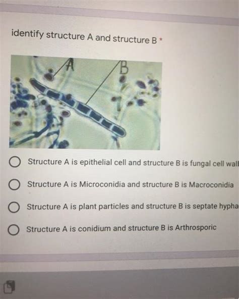 Solved identify structure A and structure B* Structure A is | Chegg.com