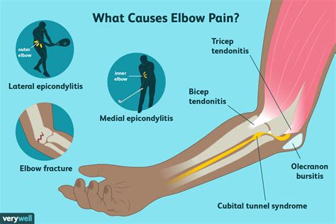 Singapore Elbow Injury Specialist | Singapore Sports and Orthopaedic Clinic - Neurosurgeon