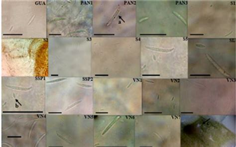 Reproductive structures (macro and microconidia) and formation of... | Download Scientific Diagram