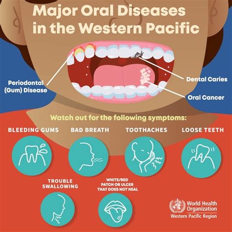 Teeth Mouth Diseases