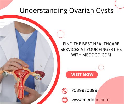 Understanding Ovarian Cysts: Causes, Symptoms, and Treatment Options