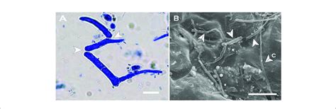 | Arthrospores produced by Neopseudocercosporella capsellae... | Download Scientific Diagram