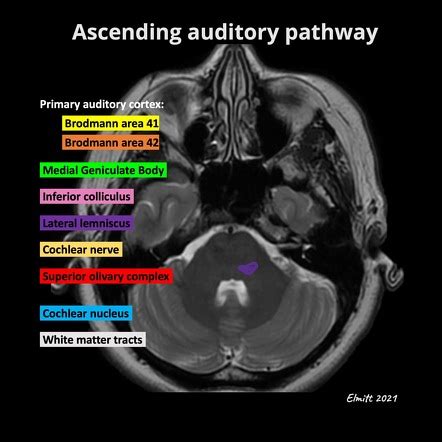 Inferior Colliculus Mri