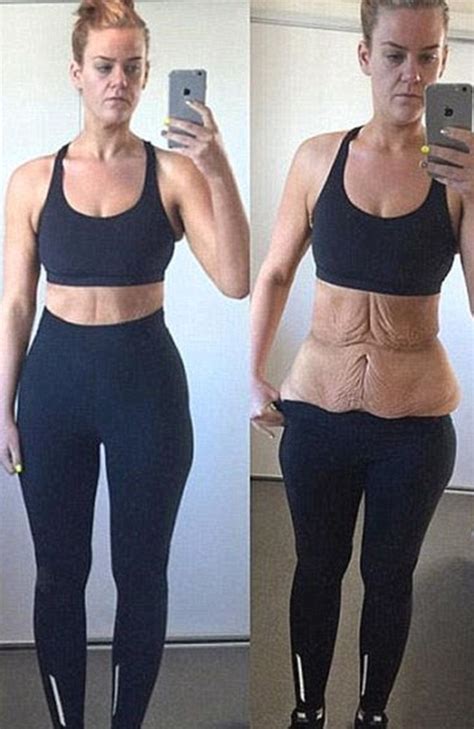 Simone Anderson weight loss: Woman shares photo of amazing body after excess skin removal ...