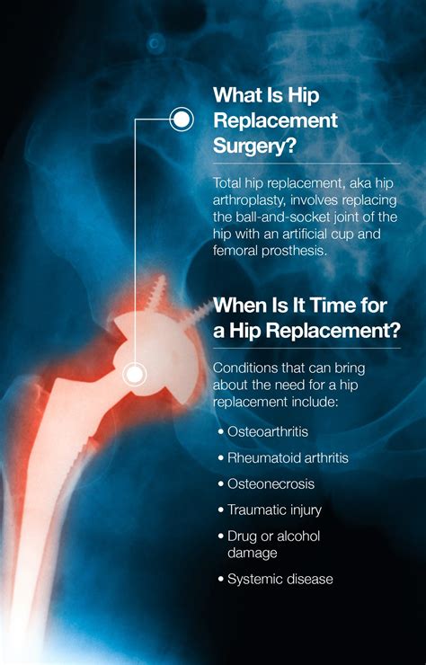 Hip Replacement Recovery: How Amino Acids Make A Difference – The Amino Company