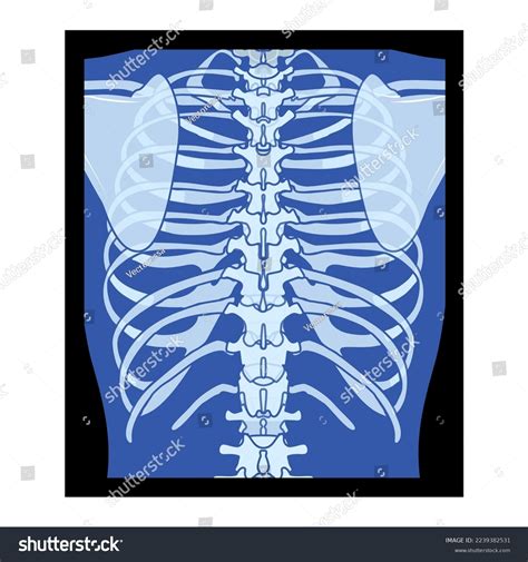 X-ray Rib Cage Skeleton Human Body Stock Vector (Royalty Free) 2239382531 | Shutterstock