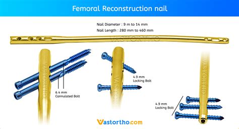 Femoral Reconstruction Nail uses, sizes & surgical • Vast Ortho