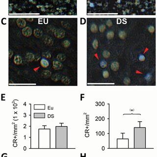 Anatomy of the subiculum in neonate mice. A–D. Nissl‐stained coronal... | Download Scientific ...