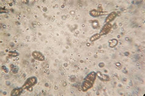 Microscopy of the Alternaria Fungus Macroconidia Stock Photo - Image of fungus, flavus: 178382694