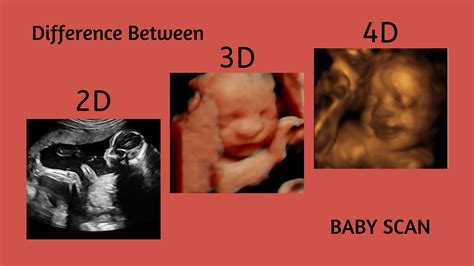 3d vs 4d ultrasound - hollywoodmyte