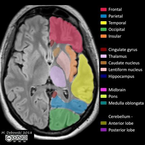 Neuroanatomy | Radiology Reference Article | Radiopaedia.org | Radiology, Radiology student ...