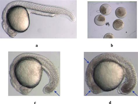 Morphological changes of zebrafish embryos: (a) untreated embryo (24... | Download Scientific ...