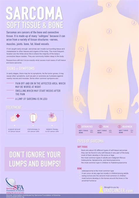 Patient Resources- What is Sarcoma? Treatments & More.