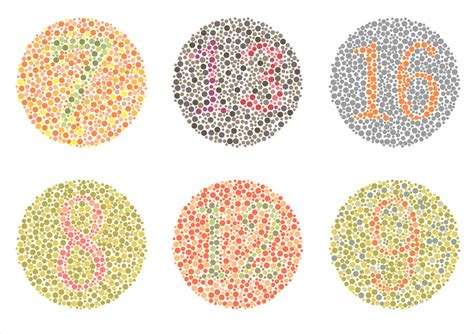 Color Vision Test | Eye Patient