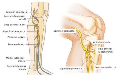 Common Peroneal Nerve