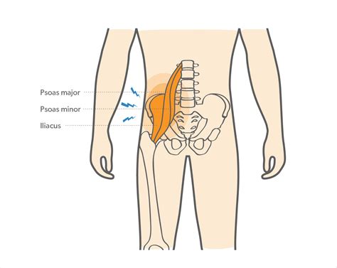 What is Hip Flexor Strain & How to Recover from It? - Upswing Health