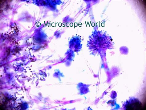 Microscope World Blog: Science Project: Mold under the Microscope