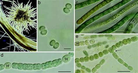 Species Of Cyanobacteria With Microscope Photos