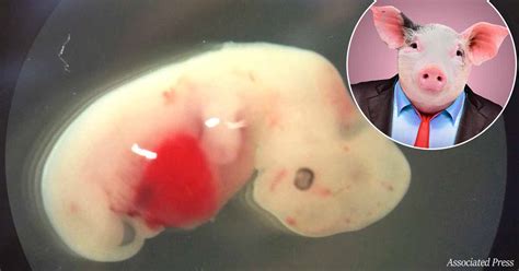 Scientists Create First Human-Pig Hybrid Embryo