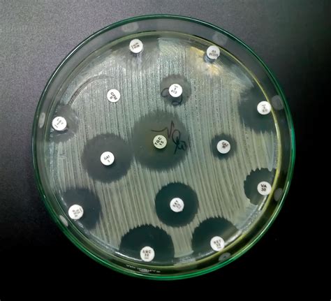 Antimicrobial susceptibility testing in petri dish. Antibiotic resistance test of bacteria ...