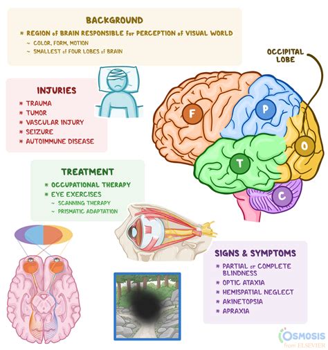 Occipital Lobe: What Is It, Its Function | Osmosis