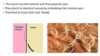 Trichuris trichiura | PPT