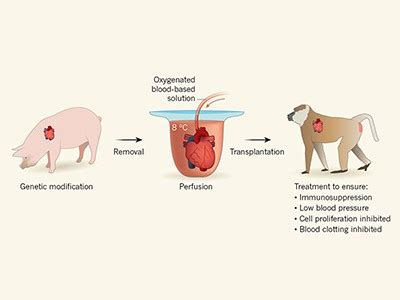 First pig-to-human heart transplant: what can scientists learn? - Nature | Hiswai