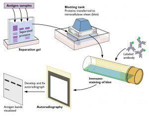 Virology toolbox: the western blot