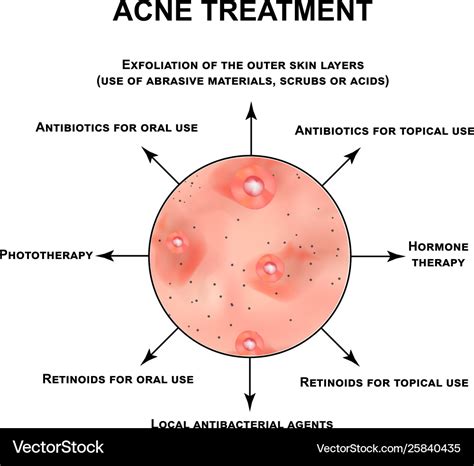 Acne treatment pustules papules comedones Vector Image