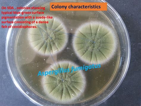 Aspergillus Fumigatus