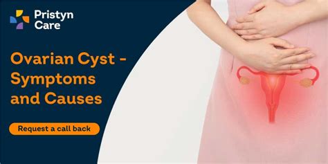 Ovarian Cyst: Causes, Symptoms And Treatment