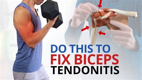 biceps tendonitis exercises pdf aaos - Augustine Childs