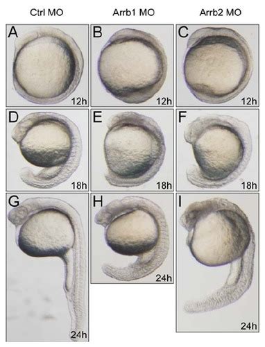 Zebrafish Embryo Development Flashcards | Quizlet