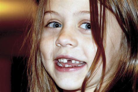 Happy Teeth: Children Rocking Missing Teeth