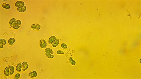 Cyanobacteria Under Microscope