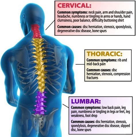 Post-Laminectomy Syndrome | Nevada Pain - Las Vegas