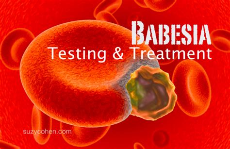 Babesia Testing and Treatment - Suzy Cohen suggests ways to heal naturally without medication