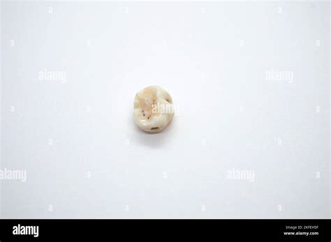 Baby milk teeth isolated on white background Stock Photo - Alamy