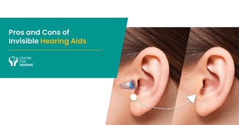 Pros-and-Cons-of-Invisible-Hearing-Aids - Centre For Hearing [Wiki]