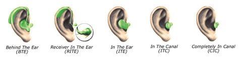 1: Different hearing aid types. | Download Scientific Diagram