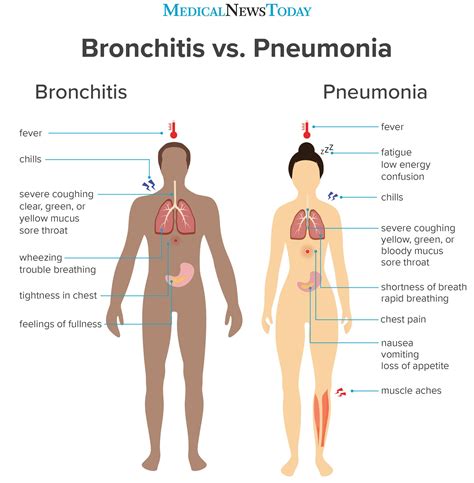 Bronchitis vs. pneumonia: How to tell