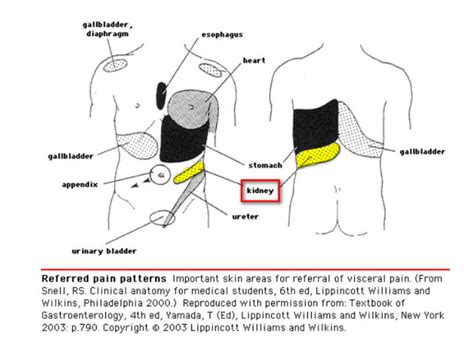 Kidney Pain : Location, Symptoms, Causes, Diagnosis, Treatment