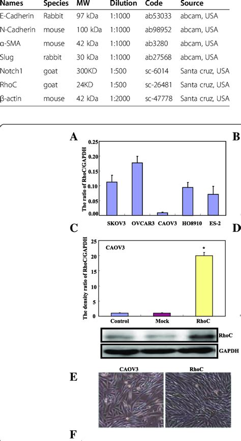 Antibodies' used in Western blot | Download Table