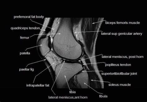 57 best MRI anatomy images on Pinterest | Radiology, Med school and Medicine