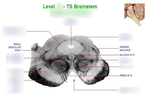 Diagram of level 13, superior colliculus | Quizlet