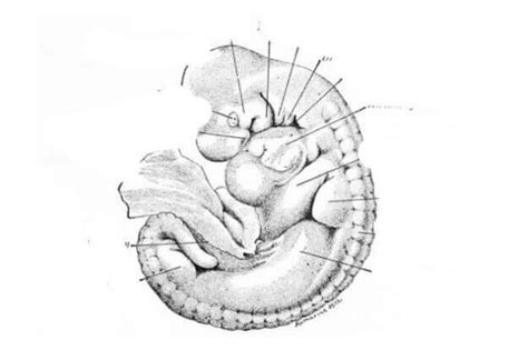 Whole mount of 6-mm pig embryo Diagram | Quizlet