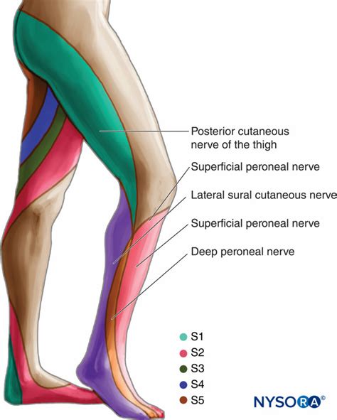 Sciatic Nerve Block - Landmarks and Nerve Stimulator Technique - NYSORA