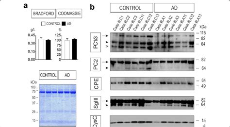 Western blot analysis of secretory proteins in the CSF of AD patients.... | Download Scientific ...